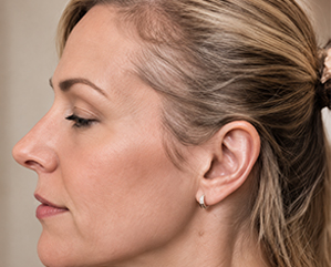 Hair before adding targeted fill-in pieces